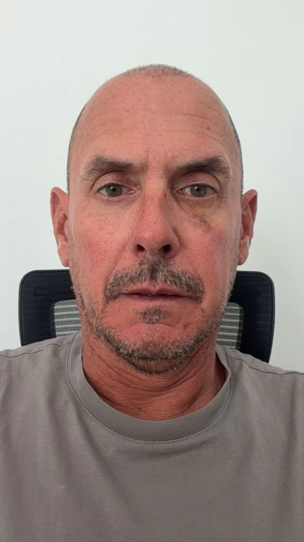 Vallilengua Marcelo Daniel